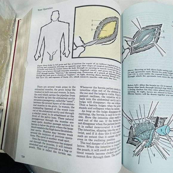 Better Homes And Gardens' Family Medical Guide 1976 Largre Book with Sleeve - Picture 14 of 16